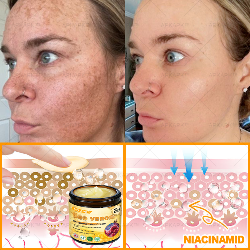 Clinically Proven Formula:✨ APKAPK® Bee venom Comprehensive Cream 🔥 Sagging Skin, Fine Lines, Loss of Firmness, Flat Bust, Drooping Hips, and More