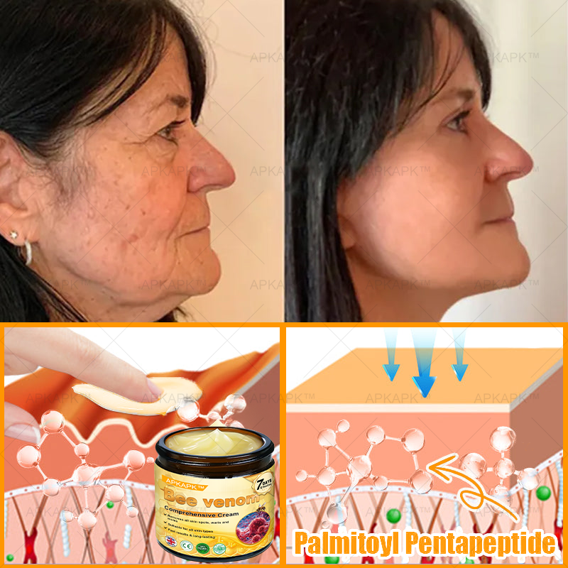 Clinically Proven Formula:✨ APKAPK® Bee venom Comprehensive Cream 🔥 Sagging Skin, Fine Lines, Loss of Firmness, Flat Bust, Drooping Hips, and More