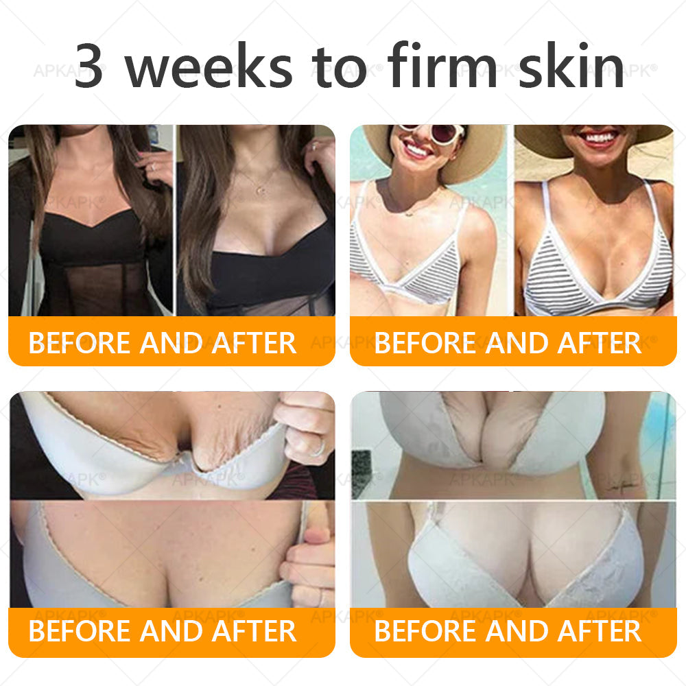 Clinically Proven Formula:✨ APKAPK® Bee venom Comprehensive Cream 🔥 Sagging Skin, Fine Lines, Loss of Firmness, Flat Bust, Drooping Hips, and More