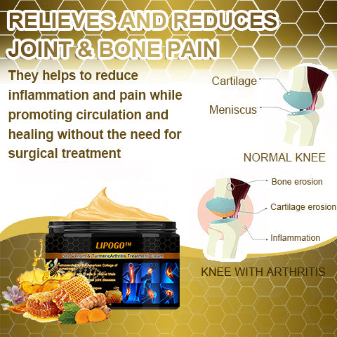 LIPOGO™ Bee Venom & Turmeric Arthritis Treatment Cream (👩‍🔬Specialized in Orthopedic Conditions and Joint Pain👩‍🔬)