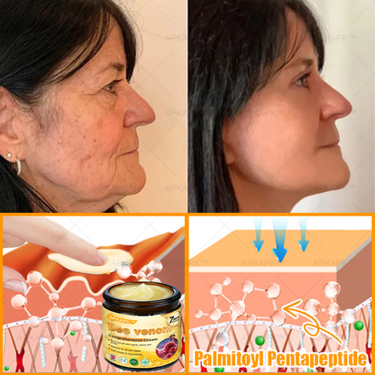 Clinically Proven Formula:✨ APKAPK® Bee venom Comprehensive Cream 🔥 Sagging Skin, Fine Lines, Loss of Firmness, Flat Bust, Drooping Hips, and More
